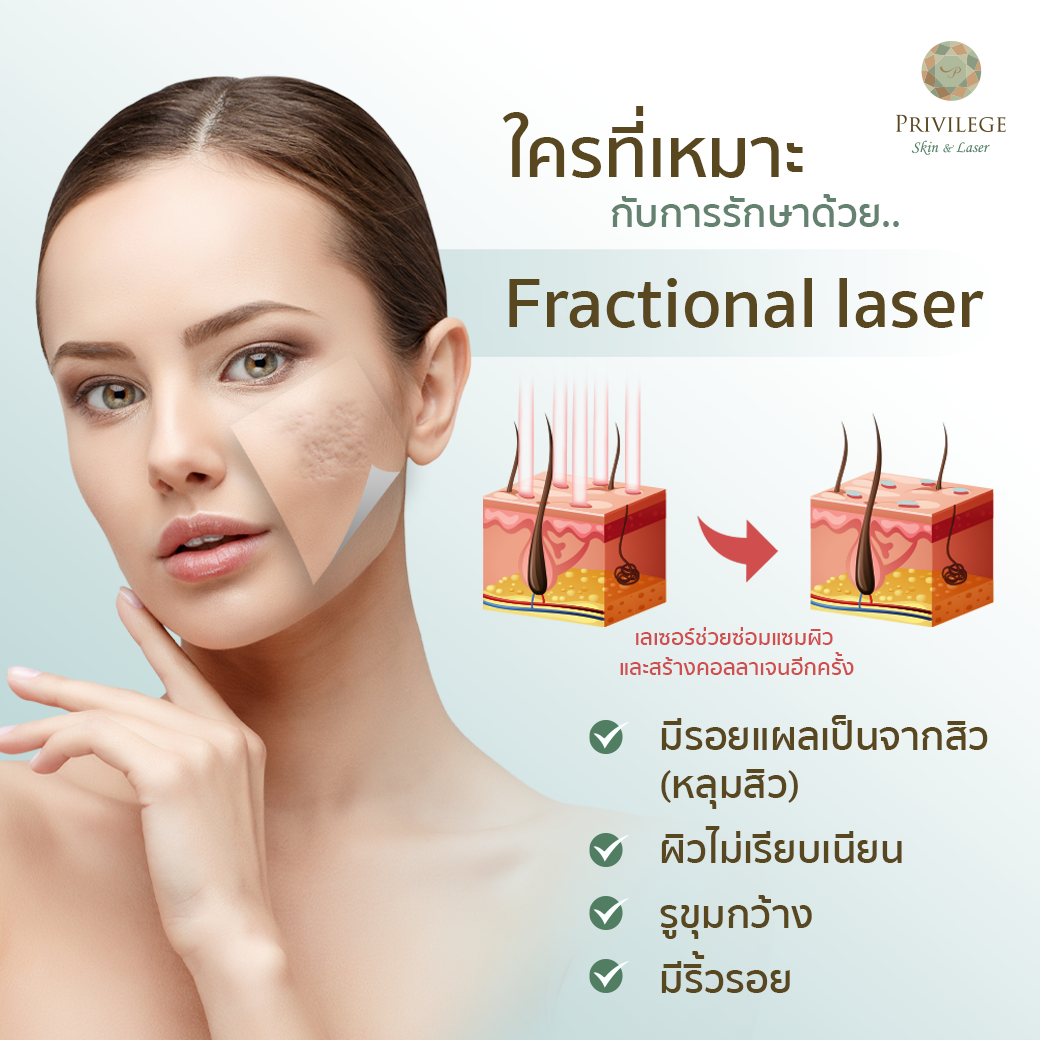 Fractional Laser Privilege Clinic